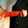 reverse-circumcision.jpg